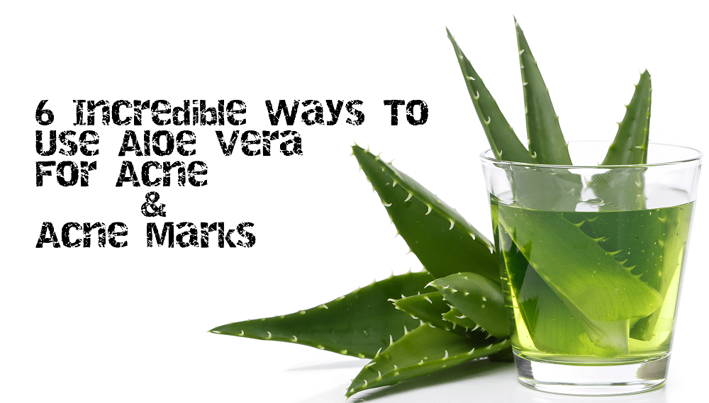 6 Incredible Ways To Use Aloe Vera For Acne & Acne Marks